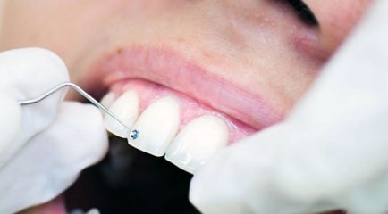 Najboljši ortodont v Mariboru